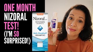 HAIR LOSS SUFFERER REVIEWS NIZORAL SHAMPOO One Month Review On 2 Ketoconazole IM VERY SURPRISED [upl. by Epilef]