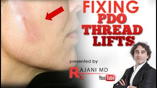 HOW TO FIX PDO THREAD LIFT PUCKERING COMPLICATIONSPDO Thread Visibility Dimpling Nodules Dr Rajani [upl. by Ambur]