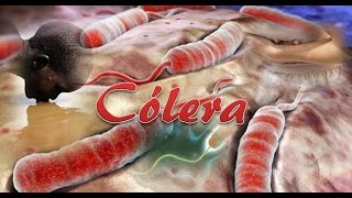 Cólera Vibrio cholerae [upl. by Ardnosal]