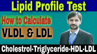 Lipid Profile Test CholestrolTriglycerideHDLLDL [upl. by Nnylsoj]